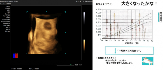 4D超音波画像と胎児発育曲線のグラフ